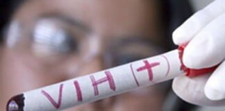 VIH: Diputados tratará en el plenario de comisiones el proyecto de ley de respuesta integral